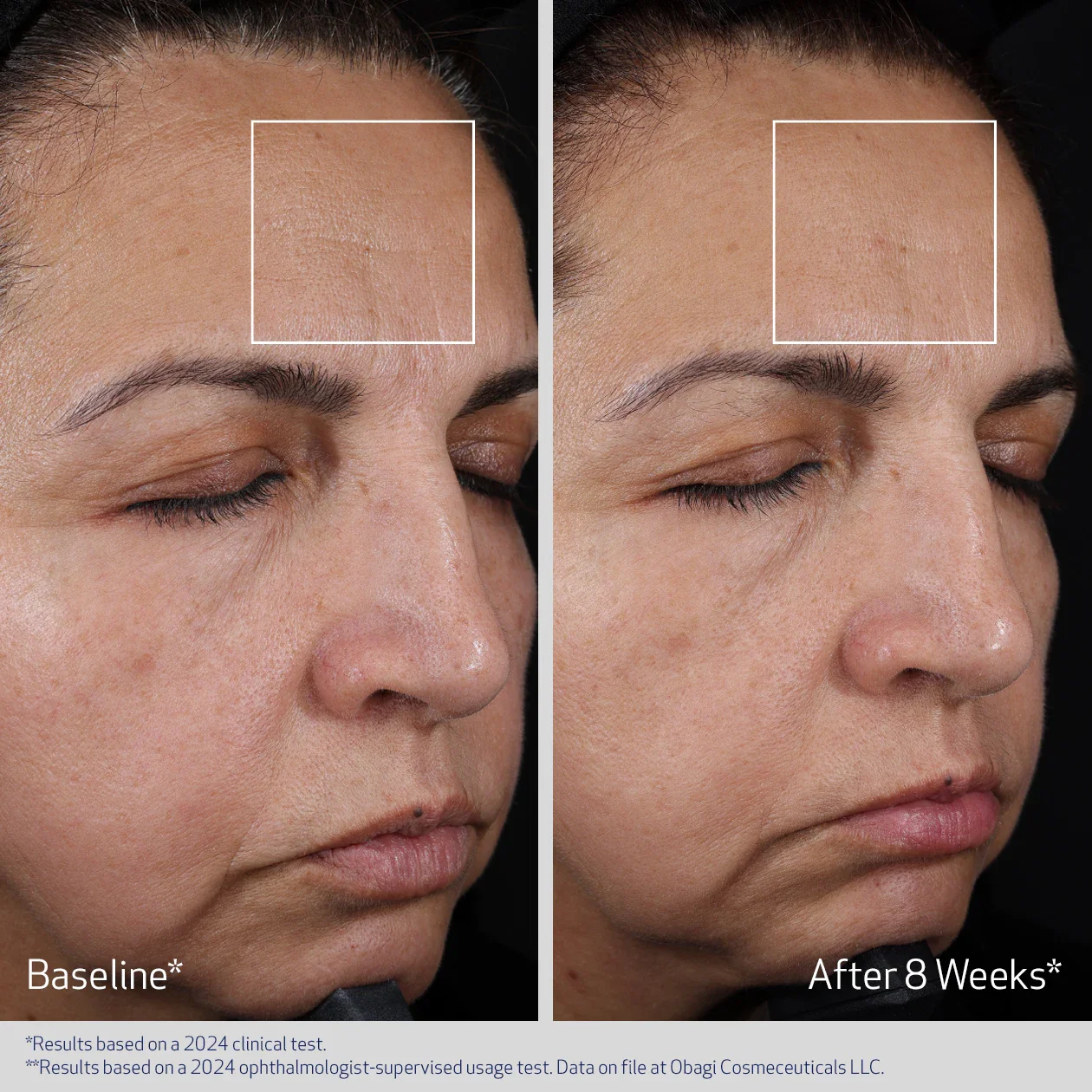 Obagi ELASTIderm Advanced Filler Concentrate 20ml - Image 6