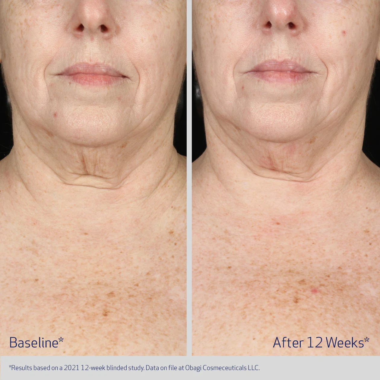 Obagi ELASTIderm Neck and Decollete Concentrate 60ml - Image 5