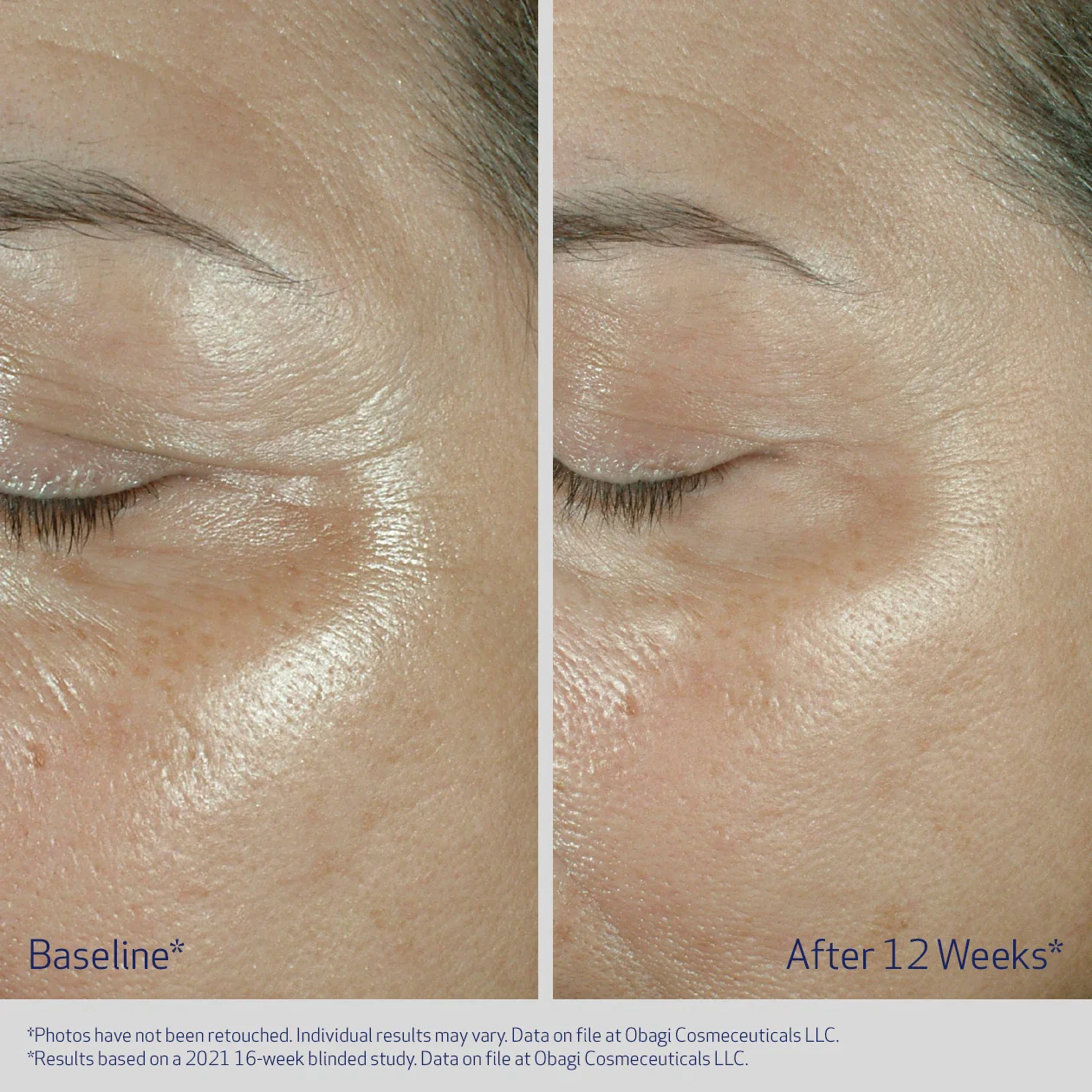 Obagi ELASTIderm Eye Cream 15g - Image 5