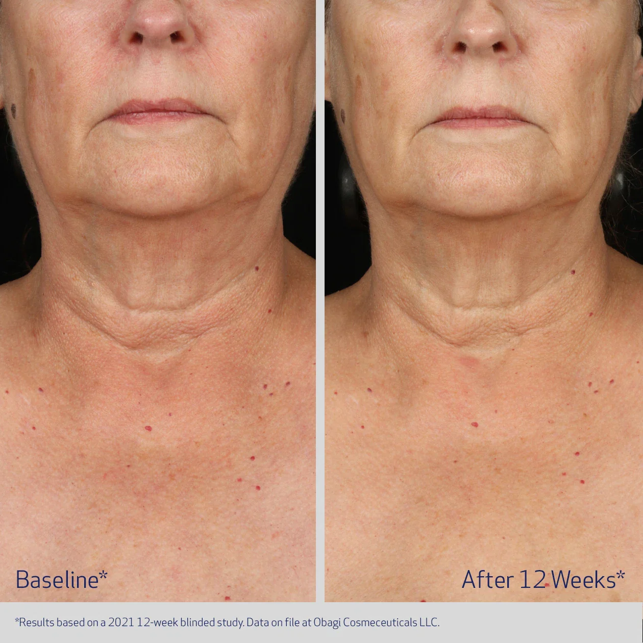 Obagi ELASTIderm Neck and Decollete Concentrate 60ml - Image 6
