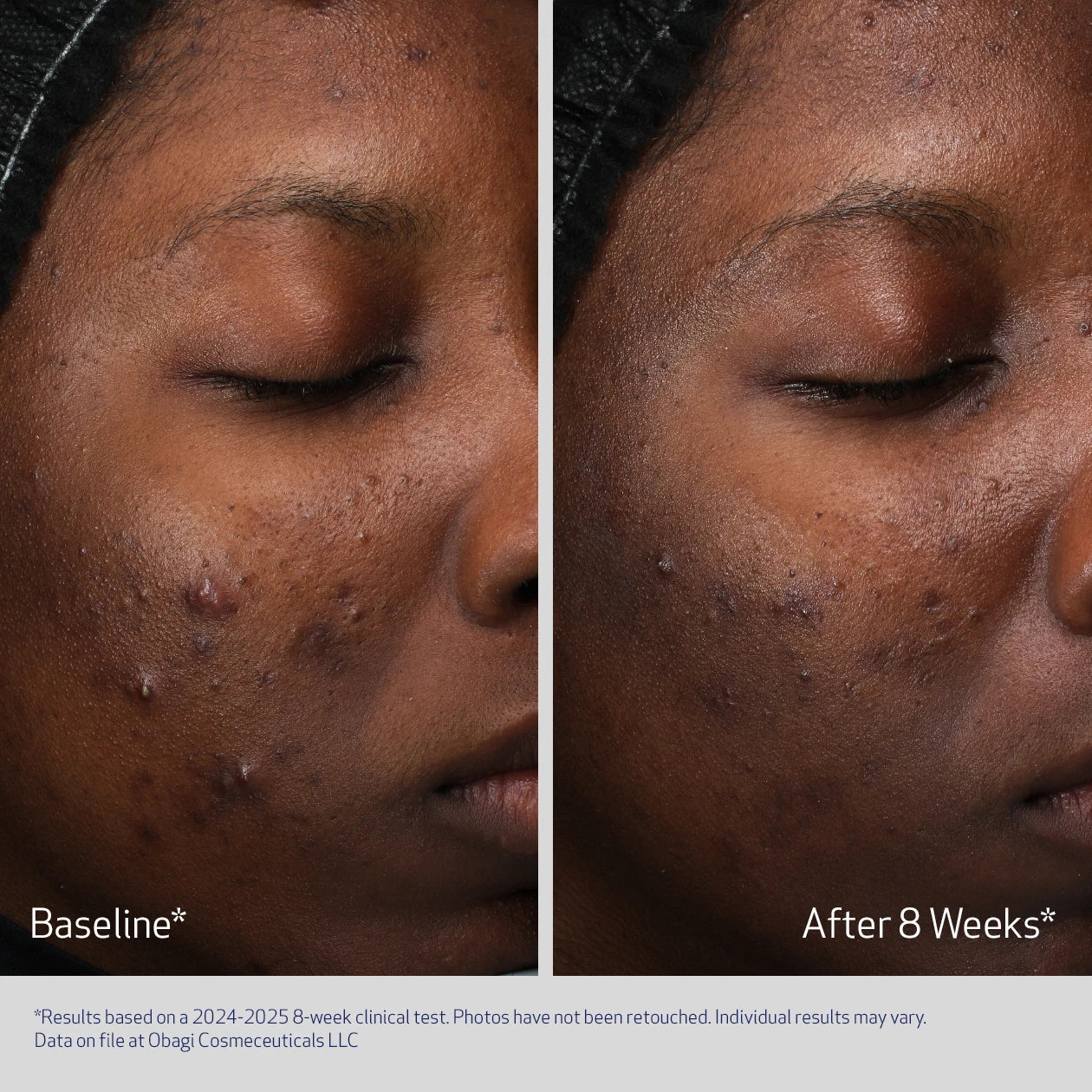 Obagi Retinol + PHA Refining Night Cream 50ml - Image 4