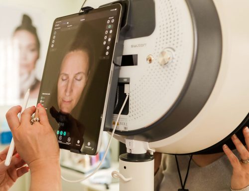 1. CONSULTATION & SKIN ANALYSIS Observ 520X