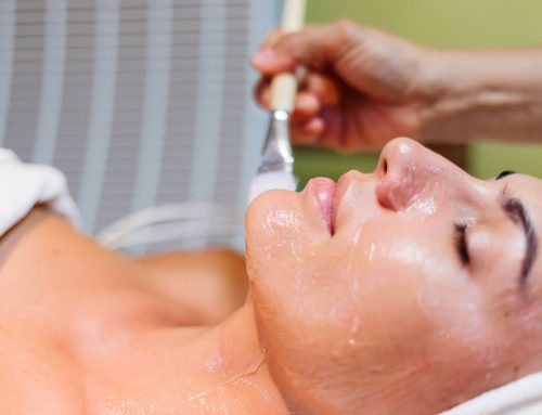6.CHEMICAL PEELS