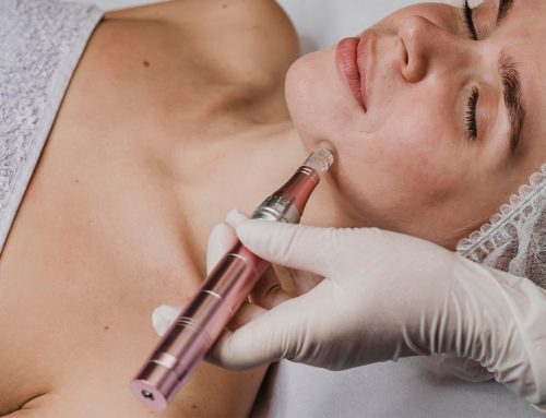 5. MEDICAL GRADE MICRONEEDLING