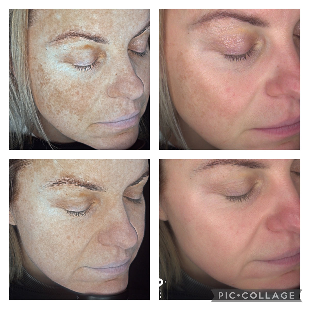 obagi-skin-care-slider